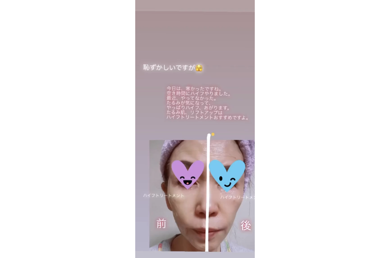 8AC0D2E3-B393-489A-B4AD-3D6CD8471DDD